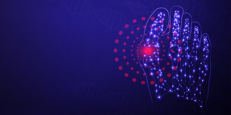 Red Highlight of Metatarsalgia